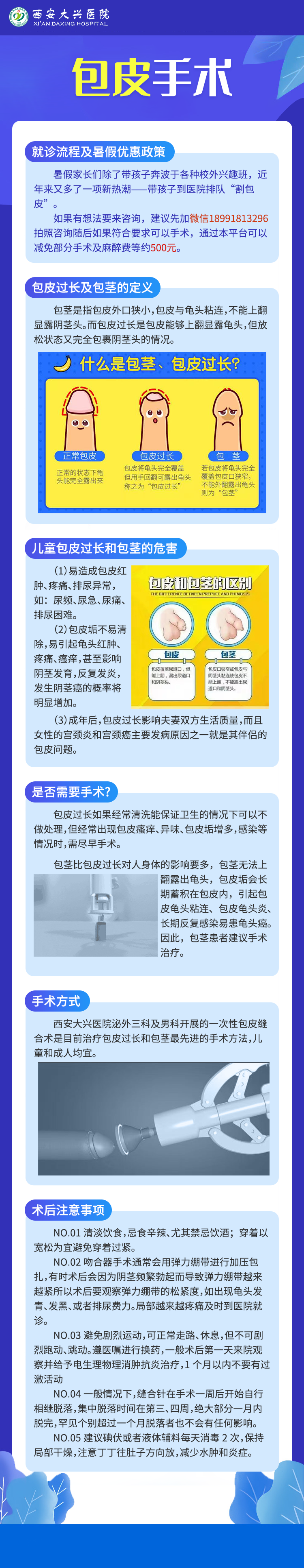 包皮手术详细.png